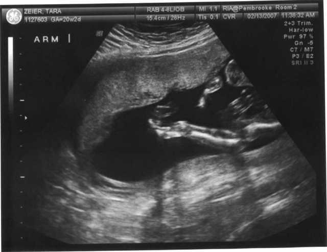 picture4